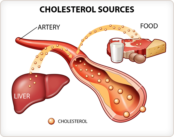 kolesterol-cholesterol